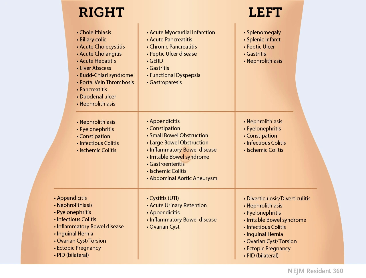 Differential diagnosis by abdominal quadrant — RUQ, epigastric, LUQ, RLQ, periumbilical, LLQ
